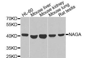 Western blot analysis of extracts of various cell lines, using NAGA antibody. (NAGA antibody  (AA 312-411))