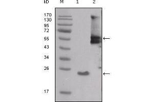 Western blot analysis using SRC mouse mAb against truncated SRC-His recombinant protein (1) and PMA treated THP-1 cell lysate (2). (Src antibody  (AA 10-193))