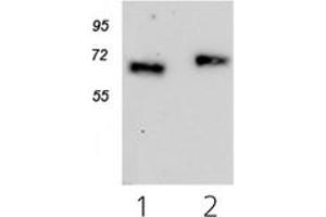Western Blotting (WB) image for anti-Cytokine Receptor-Like Factor 2 (CRLF2) antibody (ABIN1106837) (CRLF2 antibody)