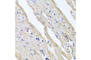 Immunohistochemistry of paraffin-embedded rat heart using RCN2 antibody at dilution of 1:100 (x40 lens).