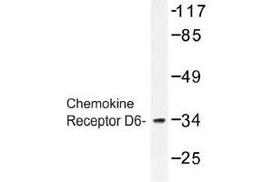 Image no. 1 for anti-Chemokine Binding Protein 2 (CCBP2) antibody (ABIN317628) (CCBP2 antibody)