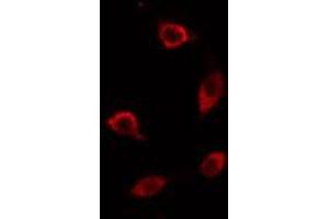 ABIN6274467 staining HT29 cells by IF/ICC. (PMEPA1 antibody  (Internal Region))