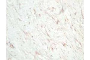 Image no. 1 for anti-Secreted Frizzled-Related Protein 1 (SFRP1) antibody (ABIN401251) (SFRP1 antibody)