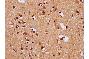 IHC image of ABIN7169865 diluted at 1:200 and staining in paraffin-embedded human brain tissue performed on a Leica BondTM system. (SNRPE antibody  (AA 1-92))