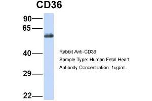 Host:  Rabbit  Target Name:  CD36  Sample Type:  Human Fetal Heart  Antibody Dilution:  1. (CD36 antibody  (N-Term))