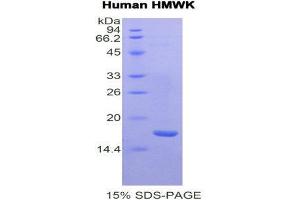 SDS-PAGE (SDS) image for Kininogen (High Molecular Weight) (AA 58-176) protein (His tag) (ABIN1877392)