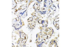 Immunohistochemistry (IHC) image for anti-Fatty Acid Binding Protein 5 (Psoriasis-Associated) (FABP5) (AA 1-135) antibody (ABIN6140422)