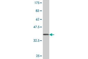 Western Blot detection against Immunogen (37. (PLD1 antibody  (AA 965-1074))