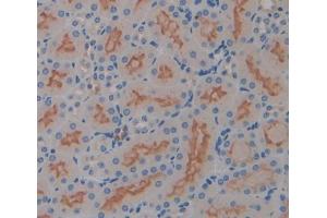 Figure. (IL17RD antibody  (AA 356-603))