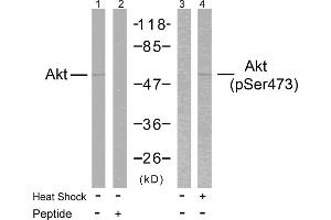 Western blot analysis of extracts from HeLa cells treated or untreated with heat shock using Akt(Ab-473) Antibody and Akt(Phospho-Ser473) Antibody. (AKT1 antibody  (pSer473))
