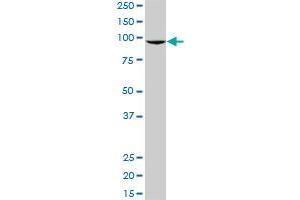 KIAA1201 polyclonal antibody (A01), Lot # ABNOVA060620QCS1. (GRAMD1B antibody  (AA 250-353))