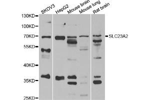 Western blot analysis of extracts of various cell lines, using SLC23A2 antibody (ABIN5974077) at 1/1000 dilution. (SLC23A2 antibody)