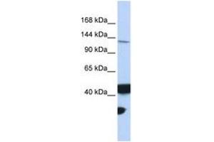 Image no. 1 for anti-MutL Homolog 3 (MLH3) (AA 1188-1237) antibody (ABIN6743100) (MLH3 antibody  (AA 1188-1237))