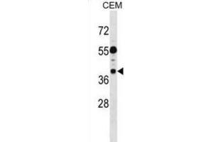 Western Blotting (WB) image for anti-Tumor Suppressing Subtransferable Candidate 1 (TSSC1) antibody (ABIN2999073) (TSSC1 antibody)