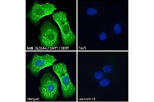 ABIN185394 Immunofluorescence analysis of paraformaldehyde fixed HepG2 cells, permeabilized with 0. (SLC6A4 antibody  (Internal Region))