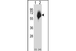 Western blot analysis of P2 (arrow) using rabbit polyclonal P2 Antibody (Center) (ABIN657616 and ABIN2846612). (MMP2 antibody  (AA 303-331))