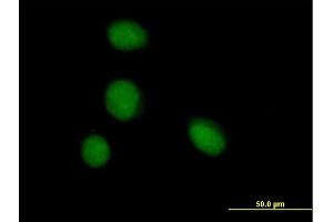 Immunofluorescence of purified MaxPab antibody to ZBTB6 on HeLa cell. (ZBTB6 antibody  (AA 1-424))