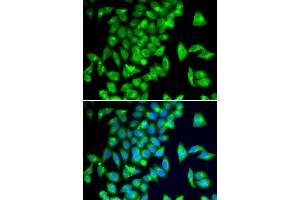 Immunofluorescence analysis of  cells using TPH2 antibody (ABIN6133469, ABIN6149436, ABIN6149437 and ABIN6222965). (Tryptophan Hydroxylase 2 antibody  (AA 1-170))