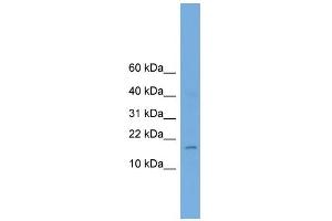 WB Suggested Anti-A830053O21Rik Antibody Titration:  0. (BHLHA9 antibody  (Middle Region))
