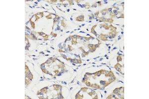 Immunohistochemistry of paraffin-embedded human stomach using DEPDC6 antibody (ABIN7266738) at dilution of 1:200 (40x lens). (DEPTOR antibody  (AA 1-220))