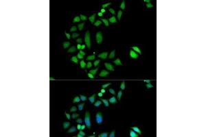Immunofluorescence analysis of MCF7 cells using CLIC1 Polyclonal Antibody (CLIC1 antibody)