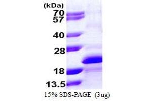 SDS-PAGE (SDS) image for Myosin Light Chain, phosphorylatable, Fast Skeletal Muscle (MYLPF) (AA 1-169) protein (His tag) (ABIN667922) (MYLPF Protein (AA 1-169) (His tag))
