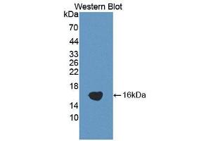 Western blot analysis of the recombinant protein. (ADAMTS1 antibody  (AA 854-967))