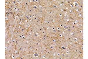 ABIN6258928 and ABIN6276017 at 1/100 staining mouse brain tissue by IHC-P.