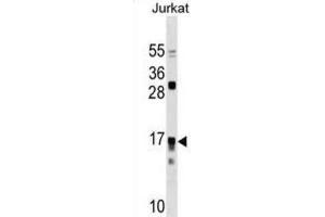 Western Blotting (WB) image for anti-Interleukin 17 Receptor C (IL17RC) antibody (ABIN3000332) (IL17RC antibody)