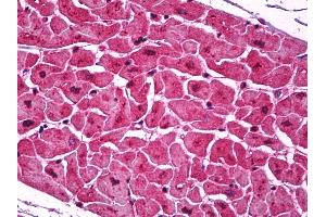 Anti-Podoplanin antibody IHC of human heart. (Podoplanin antibody  (AA 1-206))