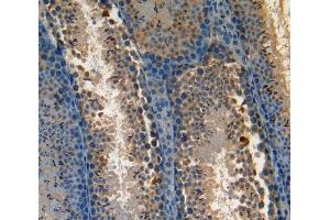 Used in DAB staining on fromalin fixed paraffin-embedded Kidney tissue (AATK antibody  (AA 137-386))