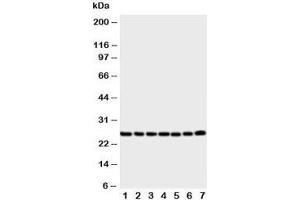 Western blot testing of SIP antibody and Lane 1:  rat liver ;  2: (r) brain;  3: (r) spleen;  4: human SMMC-7721;  5: (h) COLO320;  6: (h) SW620;  7: (h) 293T cell lysate (CACYBP antibody  (Middle Region))