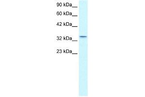 WB Suggested Anti-CLDN16 Antibody Titration:  0. (Claudin 16 antibody  (C-Term))