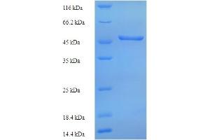 SDS-PAGE (SDS) image for Hemagglutinin Esterase (HE) (AA 19-424) protein (His tag) (ABIN5714060) (Hemagglutinin Esterase Protein (HE) (AA 19-424) (His tag))