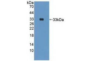 Detection of Recombinant PIK3Cd, Human using Polyclonal Antibody to Phosphoinositide-3-Kinase Catalytic Delta Polypeptide (PIK3Cd) (PIK3CD antibody  (AA 774-1044))