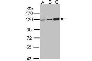 Desmoglein 2 antibody  (N-Term)