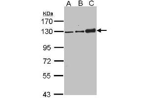 WB Image Sample (30 ug of whole cell lysate) A: 293T B: H1299 C: Molt-4 , 7. (Desmoglein 2 antibody  (N-Term))