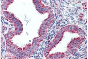 Human Uterus (formalin-fixed, paraffin-embedded) stained with HSPD1 antibody ABIN462365 followed by biotinylated anti-goat IgG secondary antibody ABIN481715, alkaline phosphatase-streptavidin and chromogen. (HSPD1 antibody)