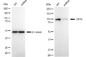 Western blotting analysis using CD10 antibody (ABIN7799365). (Recombinant MME antibody)
