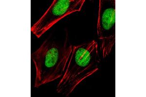 Immunofluorescent analysis of 4 % paraformaldehyde-fixed, 0. (TRRAP antibody  (C-Term))