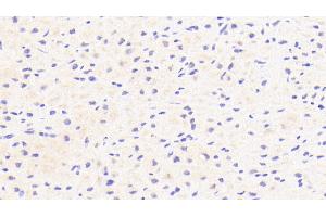 Detection of CFI in Human Cardiac Muscle Tissue using Polyclonal Antibody to Complement Factor I (CFI) (Complement Factor I antibody  (AA 28-243))
