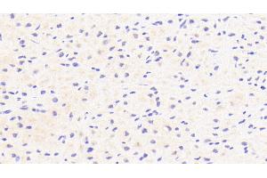 Detection of CFI in Human Cardiac Muscle Tissue using Polyclonal Antibody to Complement Factor I (CFI) (Complement Factor I antibody  (AA 28-243))