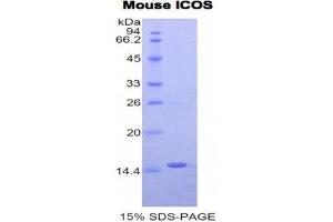 SDS-PAGE (SDS) image for Inducible T-Cell Co-Stimulator (ICOS) (AA 35-131) protein (His tag) (ABIN2121283)