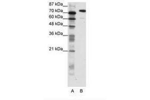 Image no. 1 for anti-SATB Homeobox 1 (SATB1) (C-Term) antibody (ABIN202904) (SATB1 antibody  (C-Term))