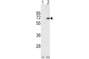 Western Blotting (WB) image for anti-SMAD Family Member 4 (SMAD4) antibody (ABIN3003471)