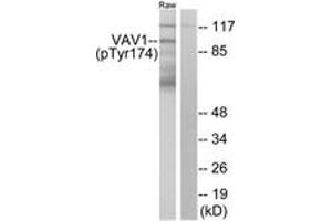 Western Blotting (WB) image for anti-Vav 1 Oncogene (VAV1) (pTyr174) antibody (ABIN2888554) (VAV1 antibody  (pTyr174))