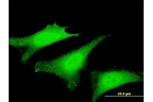 Immunofluorescence of monoclonal antibody to SVIL on HeLa cell. (Supervillin antibody  (AA 1679-1786))