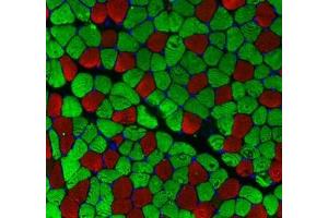 Immunofluorescent analysis of paraformaldehyde-fixed mouse skeletal muscle using MYH1 (, red) and MYH7 (ABIN7075623, green) at dilution of 1: 100 (Slow Skeletal Myosin Heavy Chain antibody)