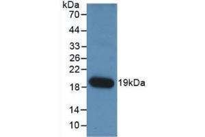 Western Blot; Sample: Recombinant ANGPT1, Human. (Angiopoietin 1 antibody  (AA 284-452))