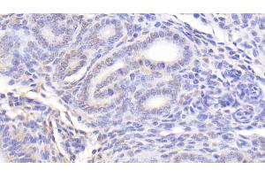 Immunohistochemistry (IHC) image for anti-Nucleolin (NCL) (AA 353-568) antibody (ABIN7434776)